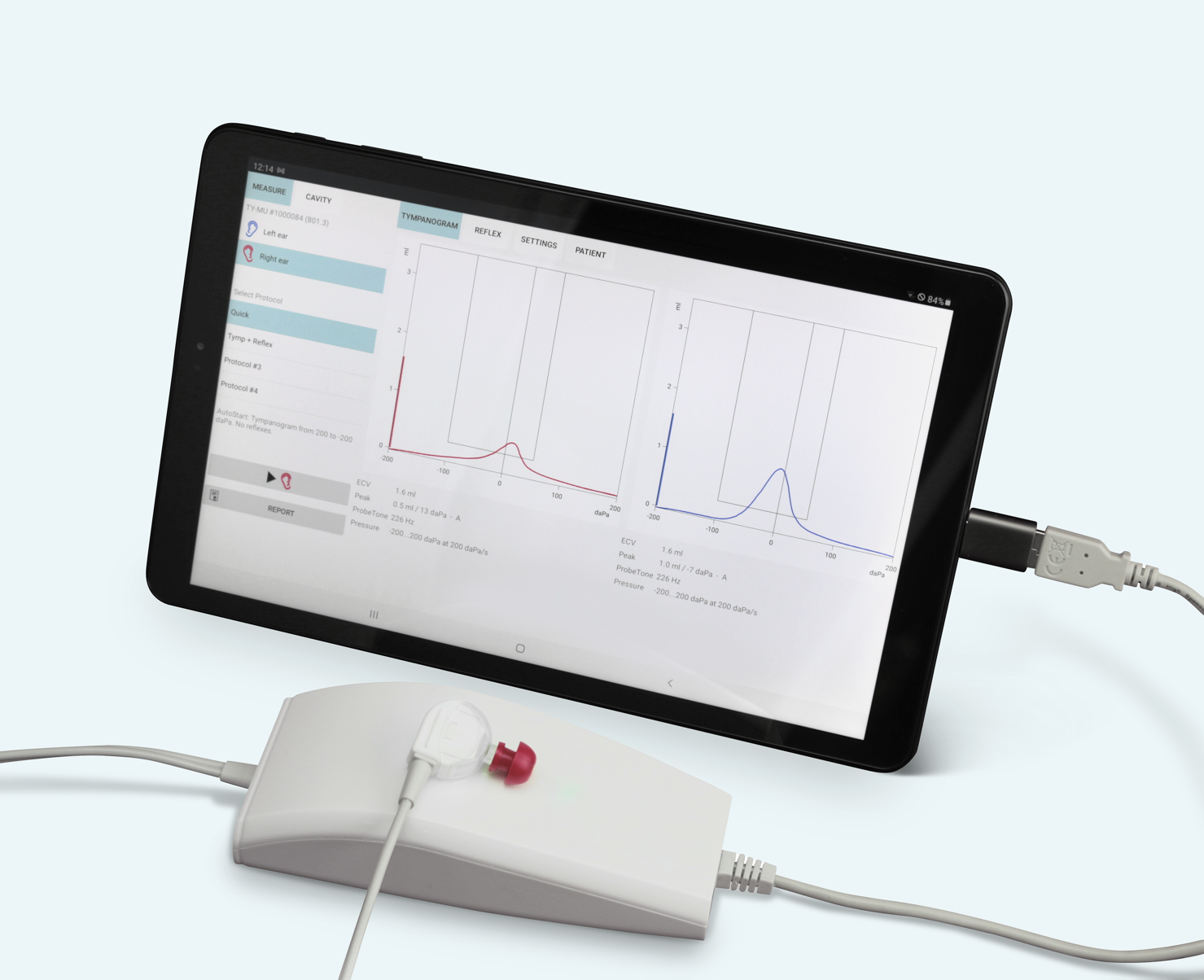 Immittance Testing Immittance Audiometry: Accoustic Immittance Testing