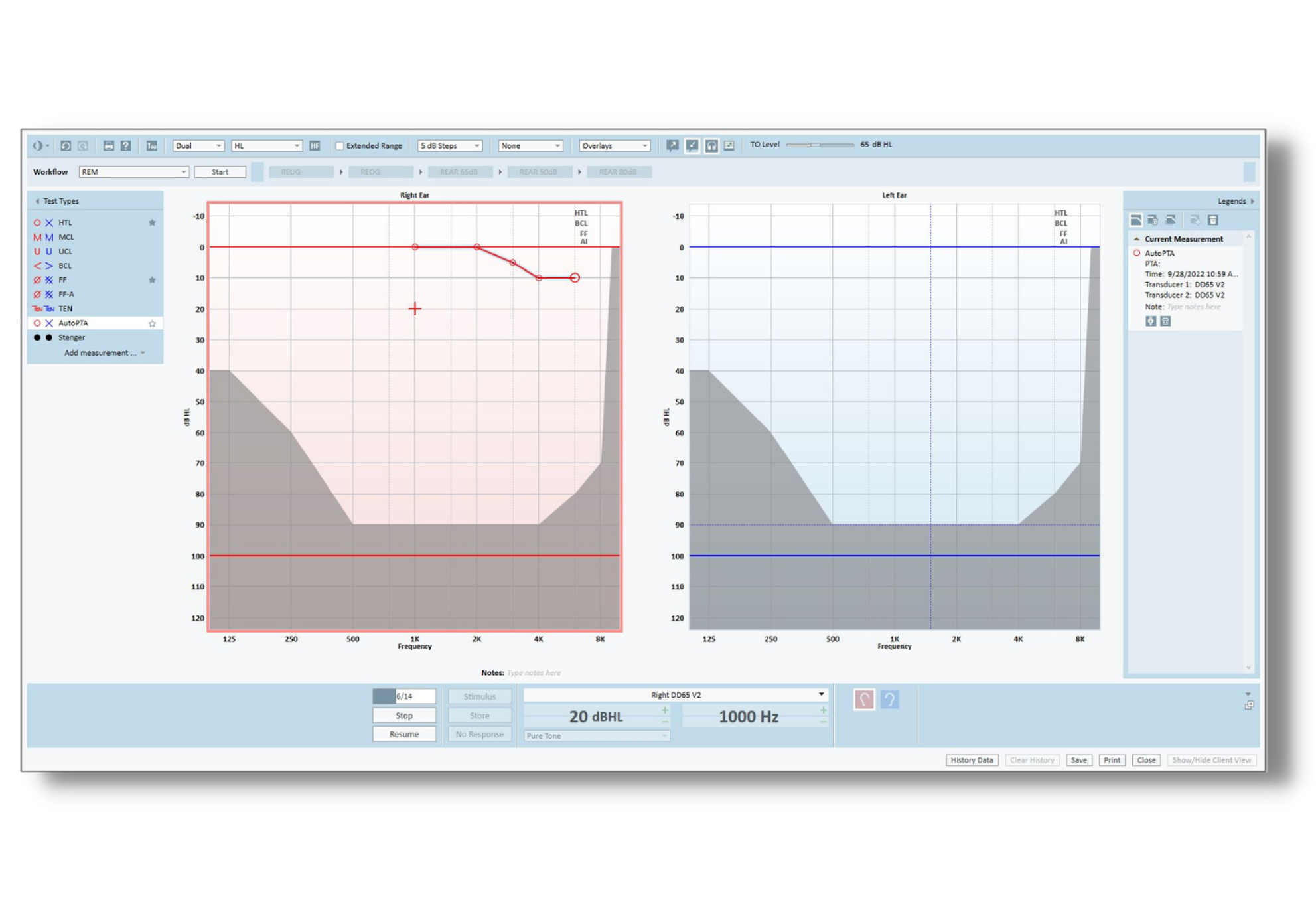 The History of Audiometry and Audiometers - Auditdata