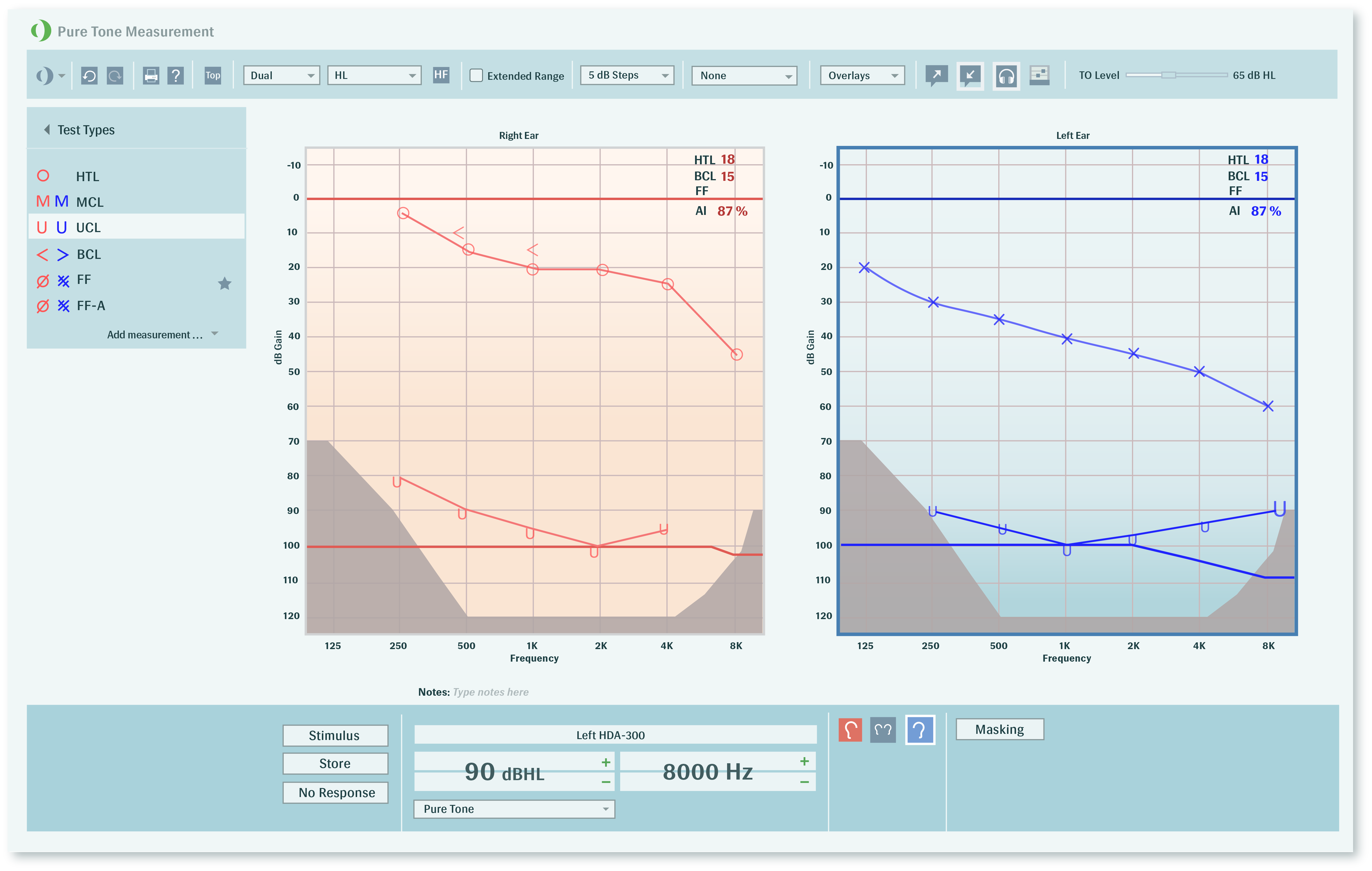 What is Pure Tone Audiometry MCL AND UCL?