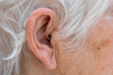 What Is the Air-Bone Gap and What Does It Mean for Hearing Health? - Image