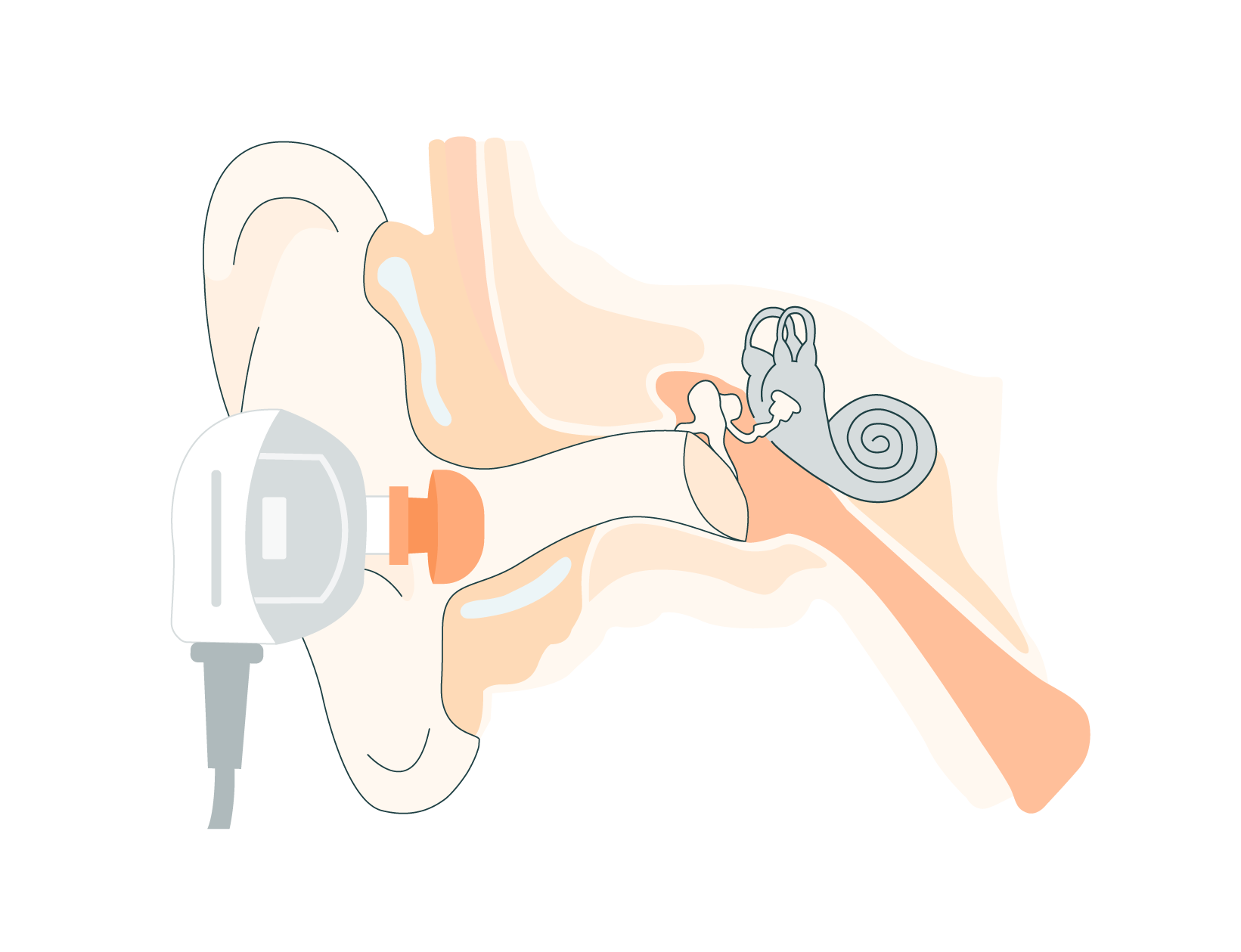 Oe In Ear OAE Test Guide: Audiology Best Practices & Tips