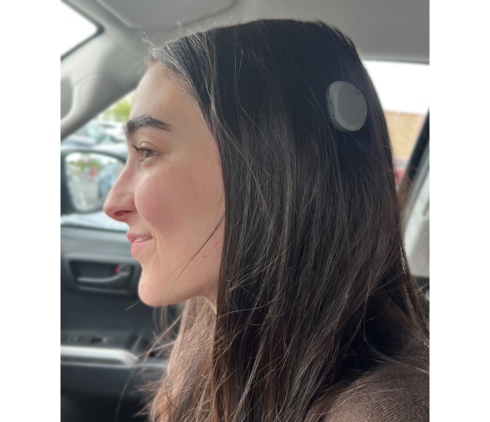 Lydia Cochlear Implant