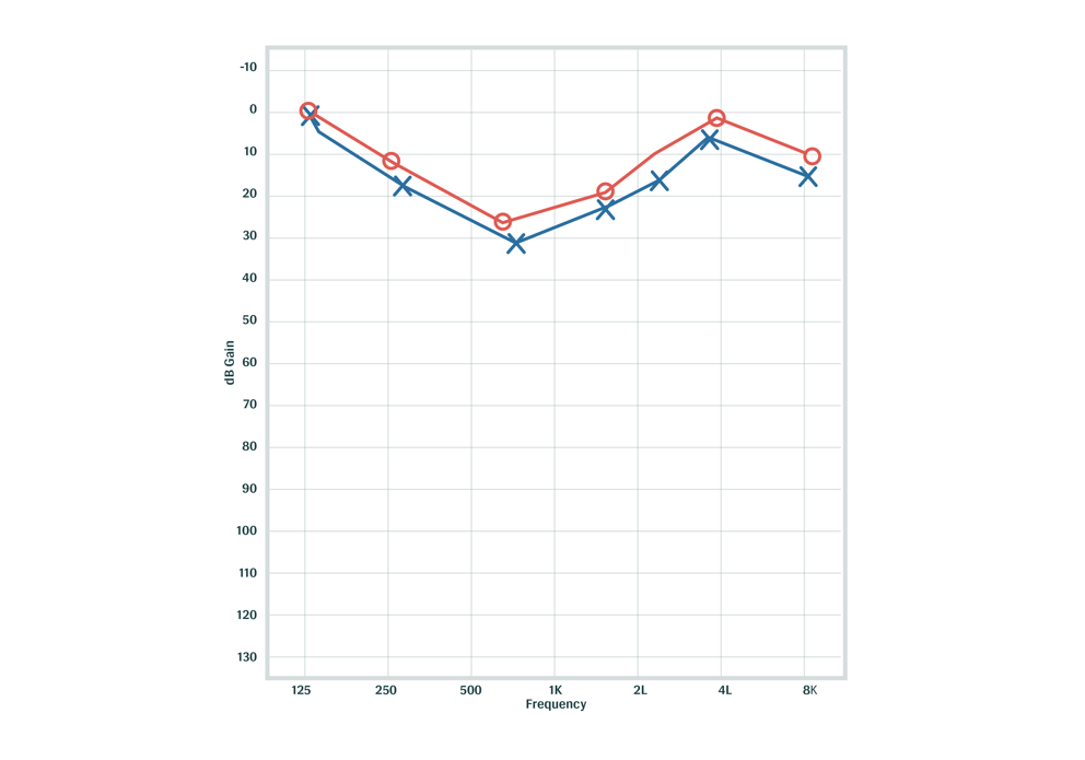 Cookie Bite Hearing Loss Audiogram