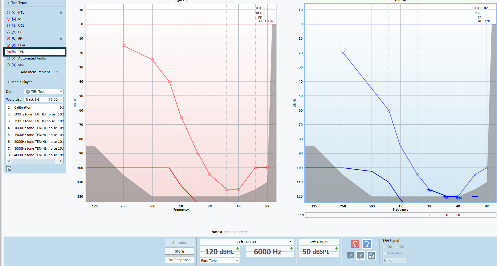 Ten Test Audiology – Interacoustics 10 Test – LHWLS