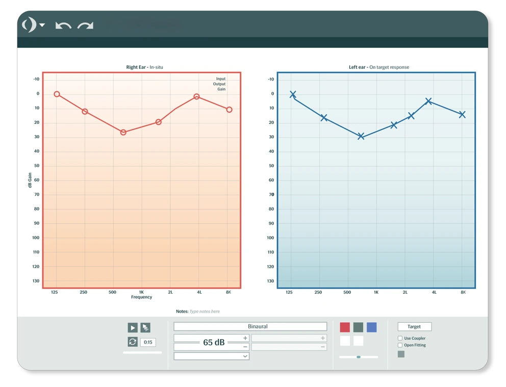cookie bite hearing loss shown on a cookie bite audiogram
