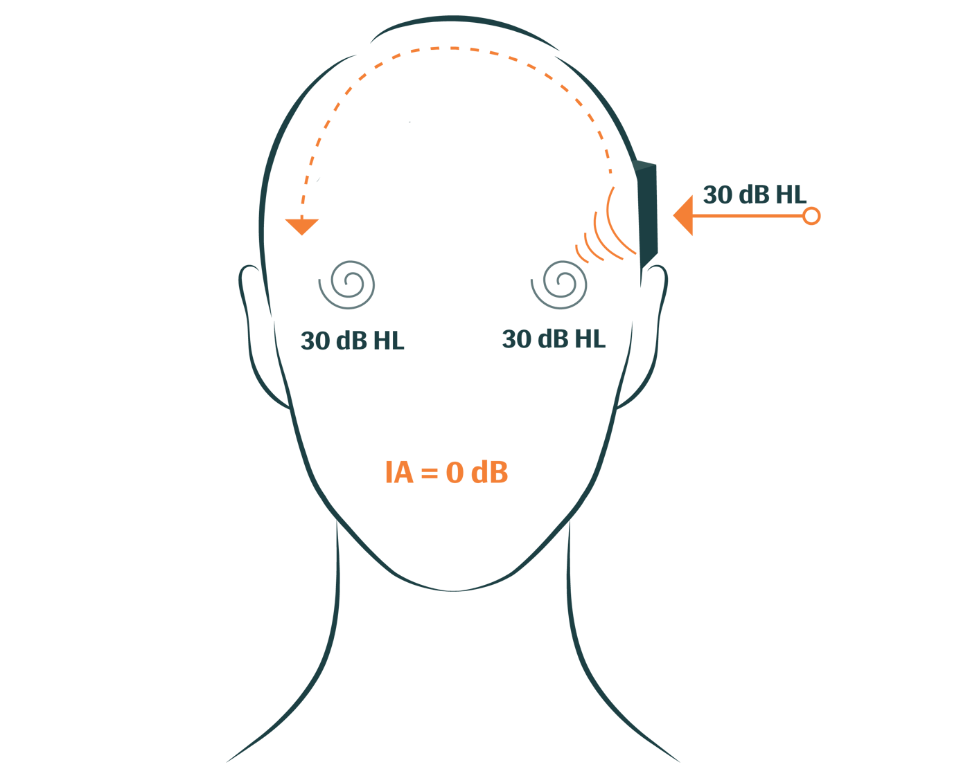 Bone Conduction Testing: What is Bone Conduction?