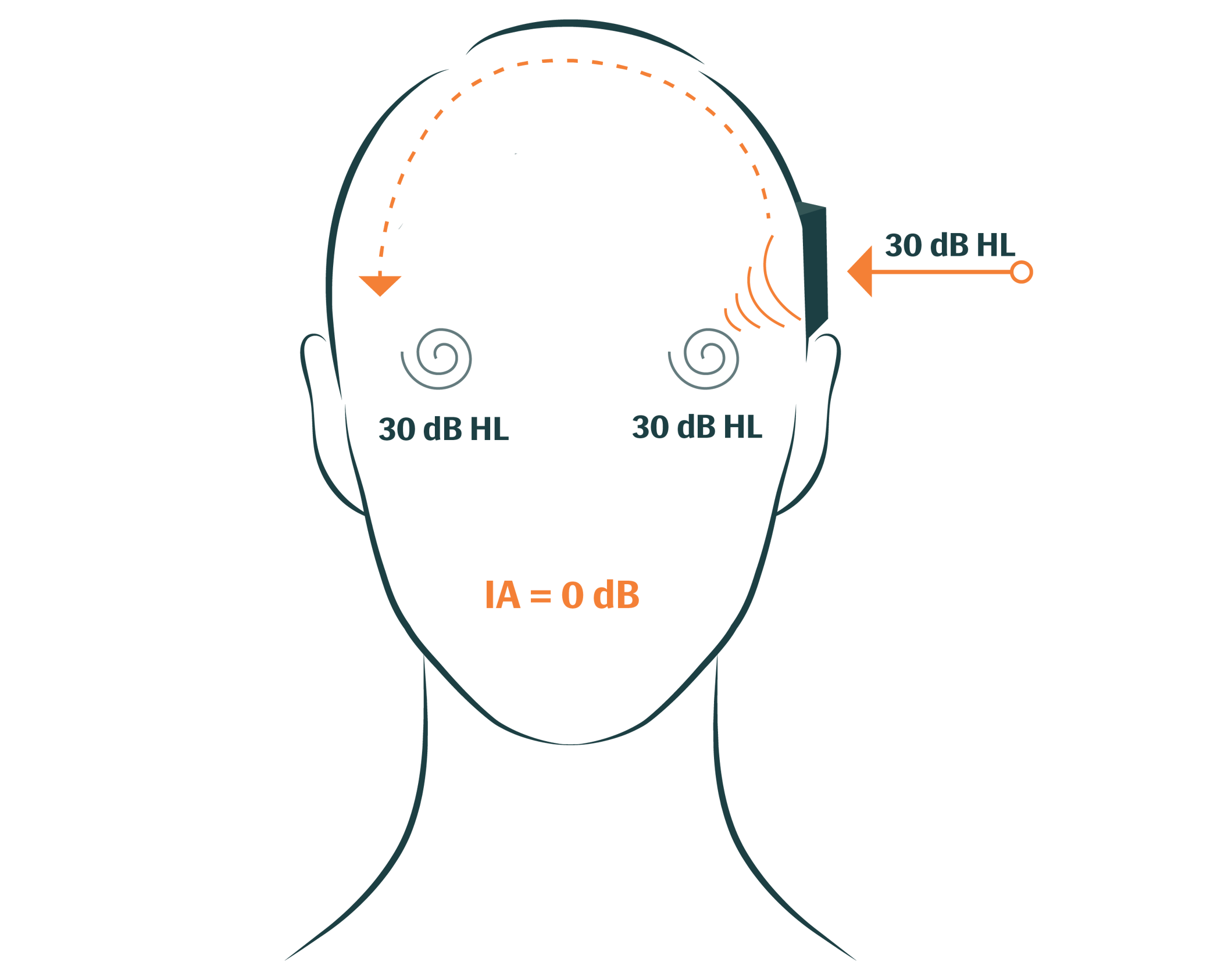 Bone Conduction Testing: What is Bone Conduction?